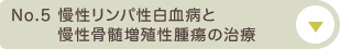 No.5 慢性リンパ性白血病と慢性骨髄増殖性腫瘍の治療について