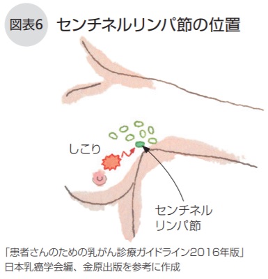 センチネルリンパ節の位置