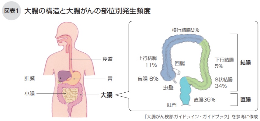 大腸の構造と大腸がんの部位別発生頻度