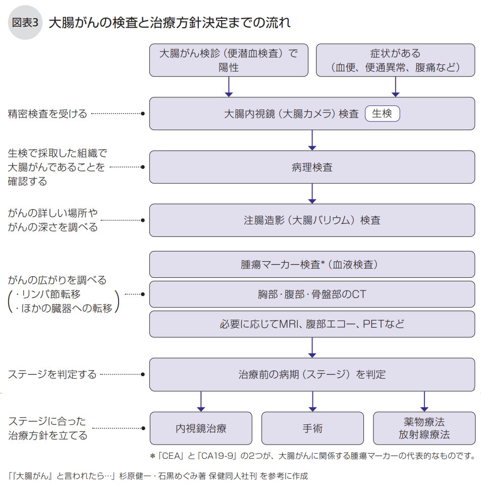 大腸がんの検査と治療方針決定までの流れ