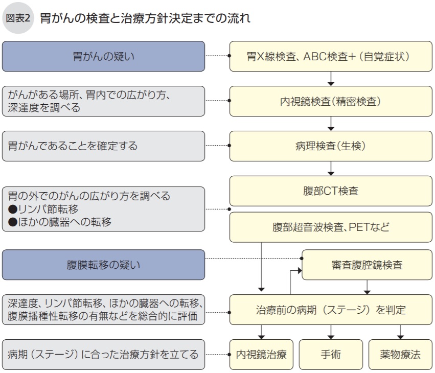 胃がんの検査と治療方針決定までの流れ