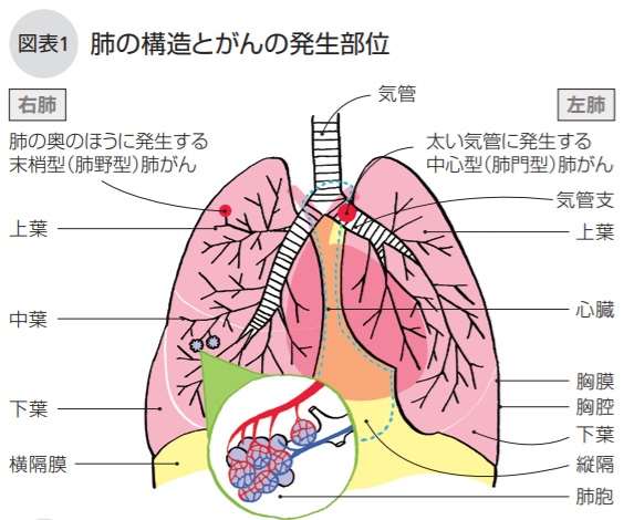 肺の構造とがんの発生部位