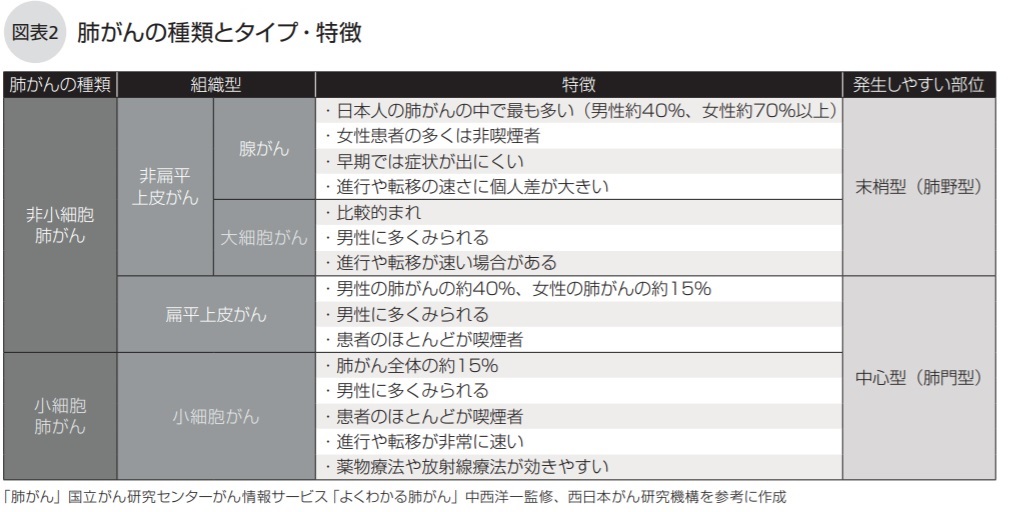 肺がんの種類とタイプ・特徴