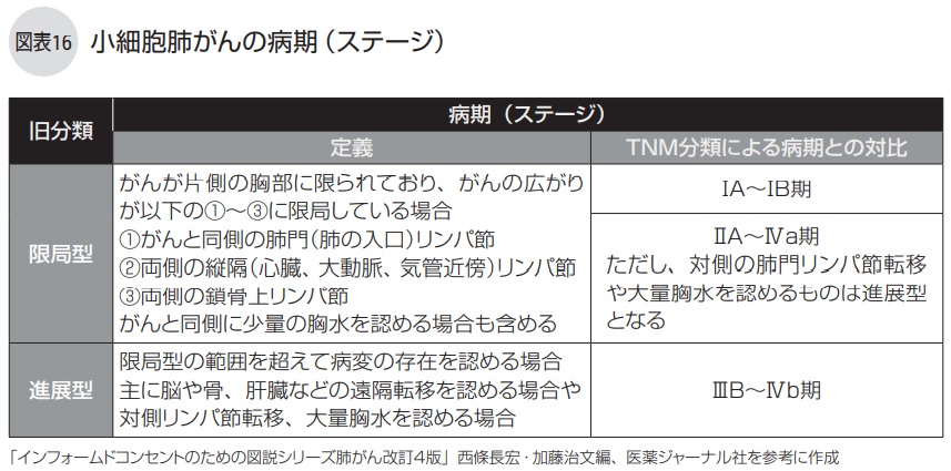 小細胞肺がんの病期（ステージ）