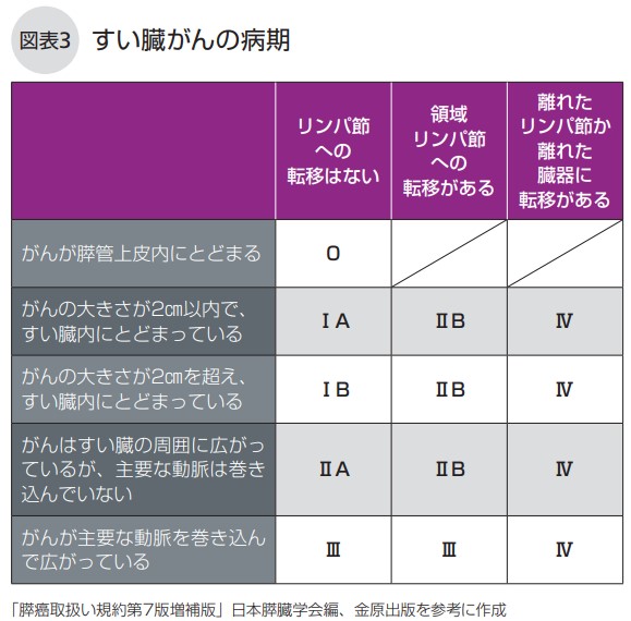 すい臓がんの病期