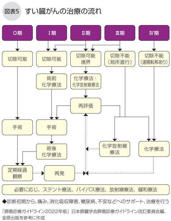 すい臓がんの治療の流れ