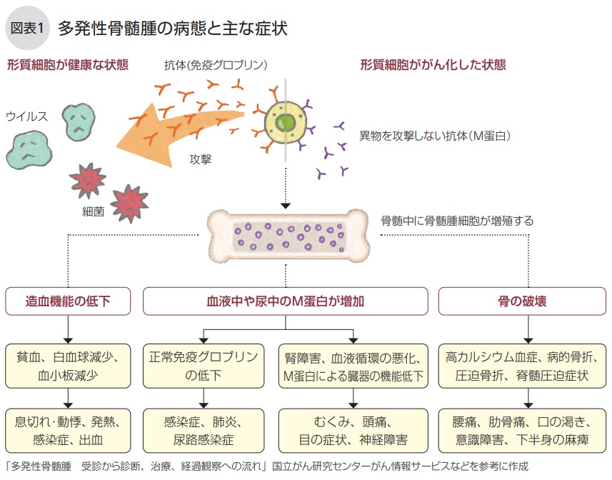 多発性骨髄腫の病態と主な症状