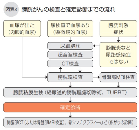 膀胱がんの検査と確定診断までの流れ