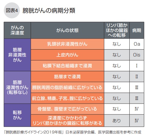 膀胱がんの病期分類