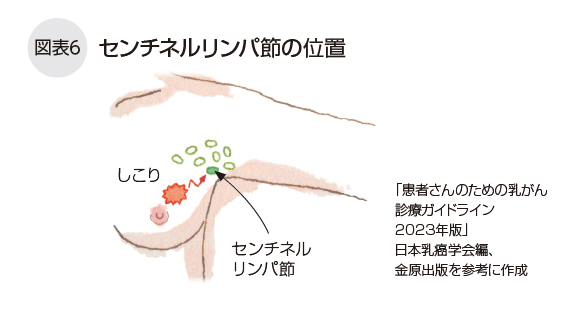 センチネルリンパ節の位置