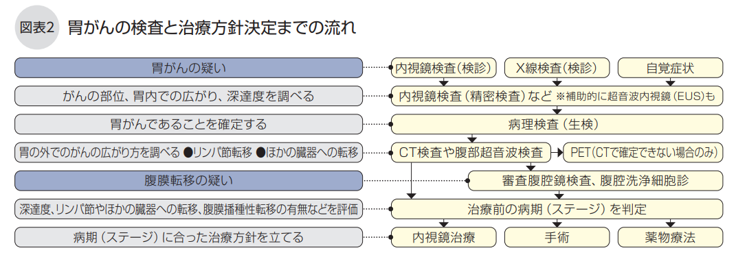 胃がんの検査と治療方針決定までの流れ