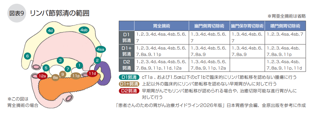 リンパ節郭清の範囲