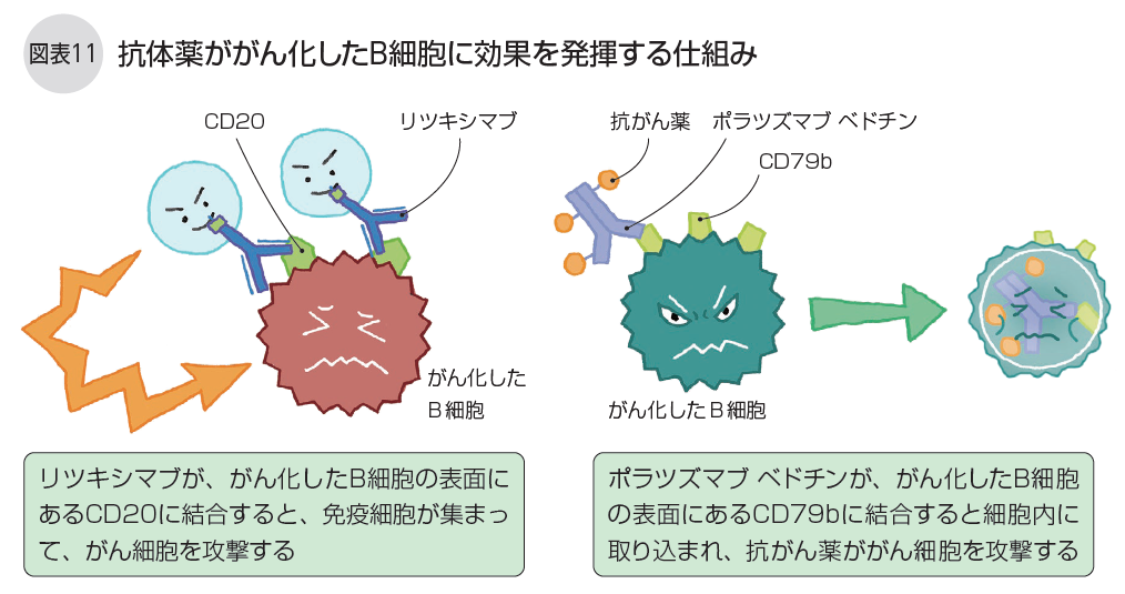 DLBCL冊子図11
