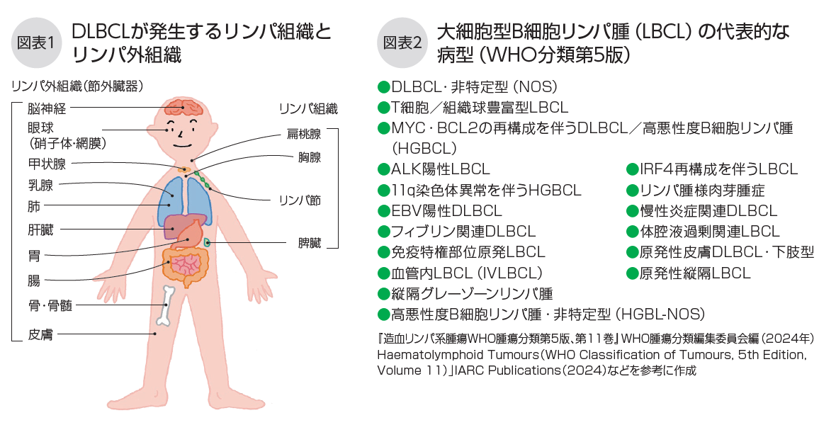 DLBCL冊子図1_2